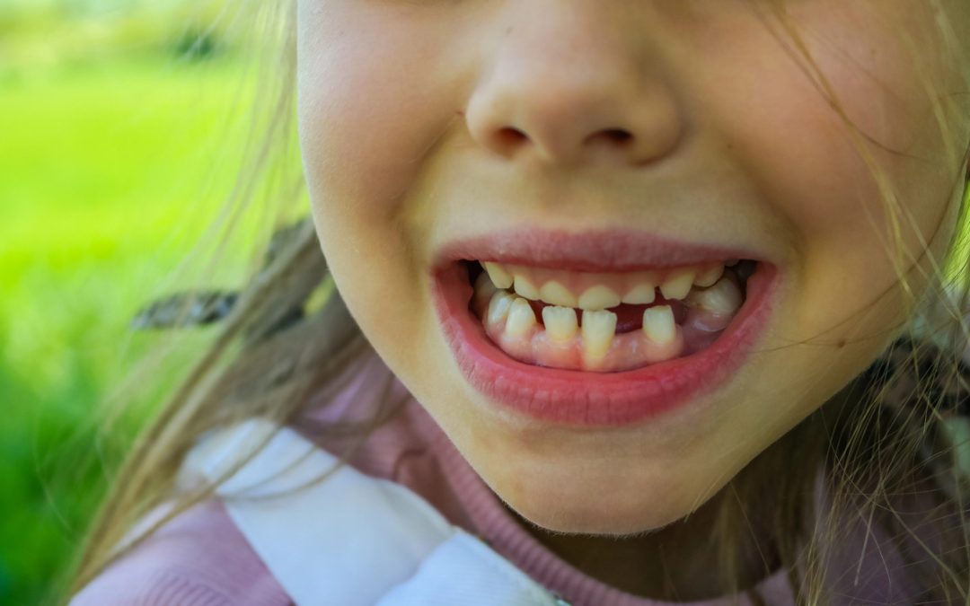 What Jaw Growth Has to Do With Sleep, Breathing, & Crowded Teeth